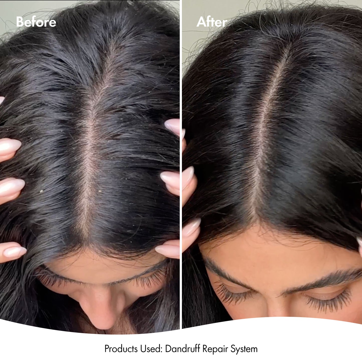 SCALP & HAIR MASK