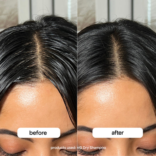 Before and after comparison of a woman's hairline using HG Dry Shampoo.