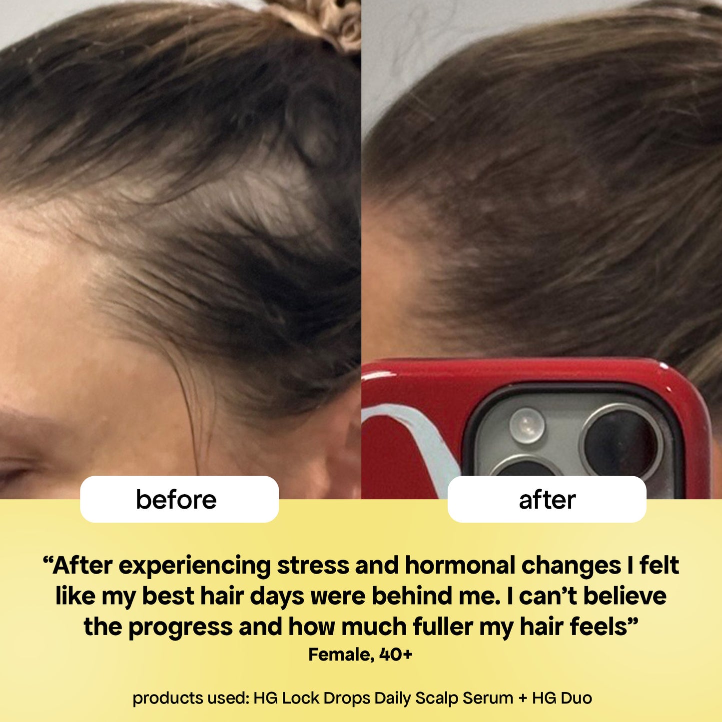 LOCK DROPS ANTI-SHEDDING SCALP & HAIR SERUM
