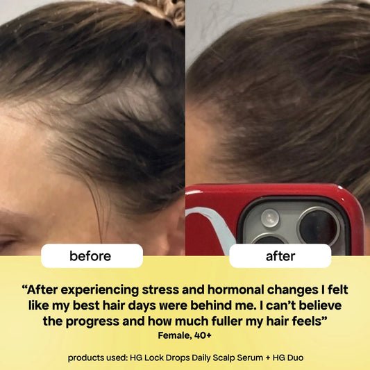 Before and after comparison of hair growth with text about product use and user experience.