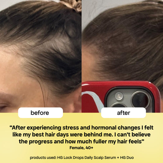 LOCK-IN THICKER HAIR: 6-MONTH SUPPLY