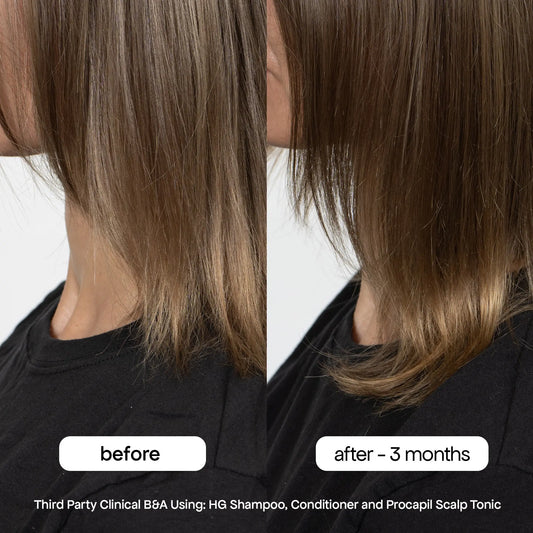 ANTI-THINNING SHAMPOO Bondi Boost