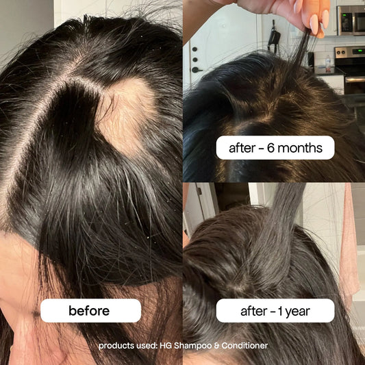 ANTI-THINNING SHAMPOO Bondi Boost