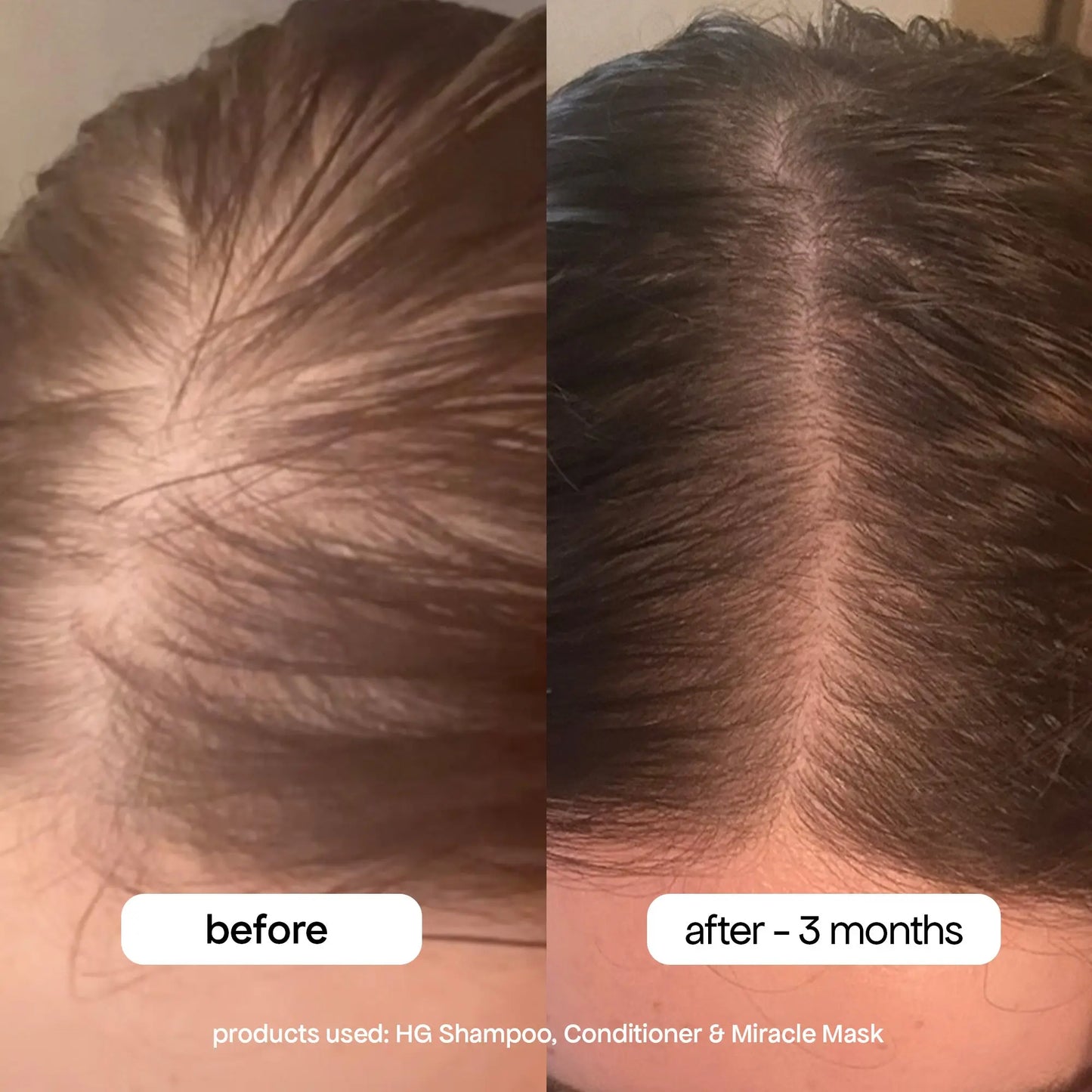 ANTI-THINNING SHAMPOO Bondi Boost