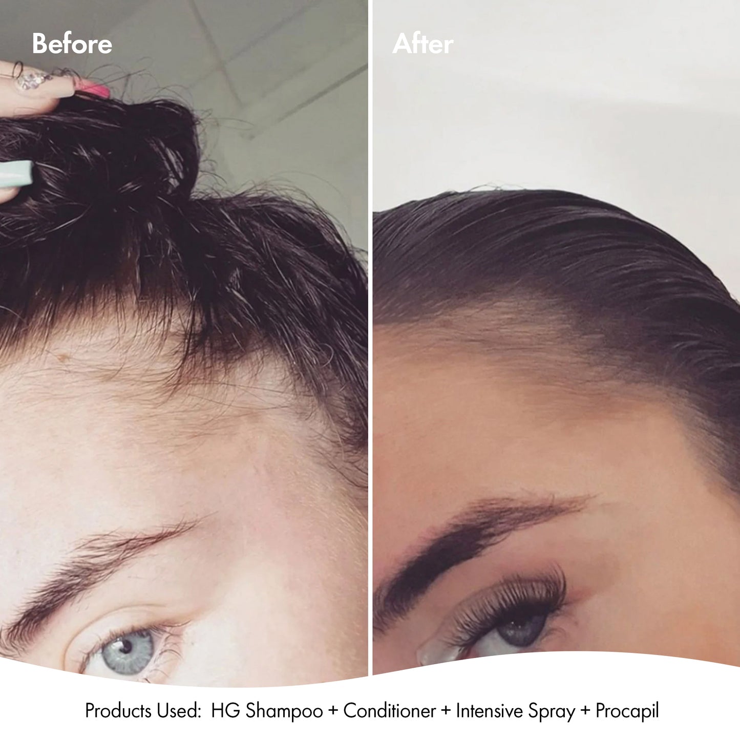 ANTI-THINNING PROCAPIL® SCALP TONIC