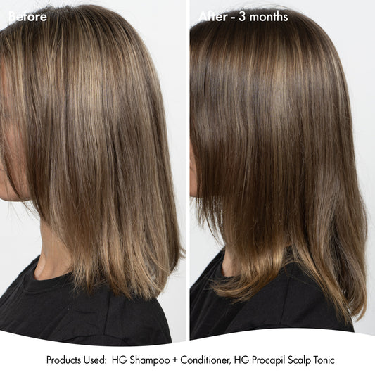ANTI-THINNING SUPER SYSTEM