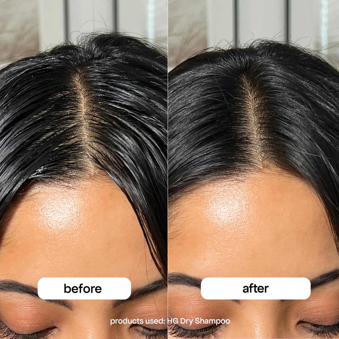 Before and after comparison of a woman's hairline using HG Dry Shampoo.