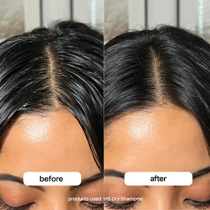 Before and after comparison of a woman's hairline using HG Dry Shampoo.