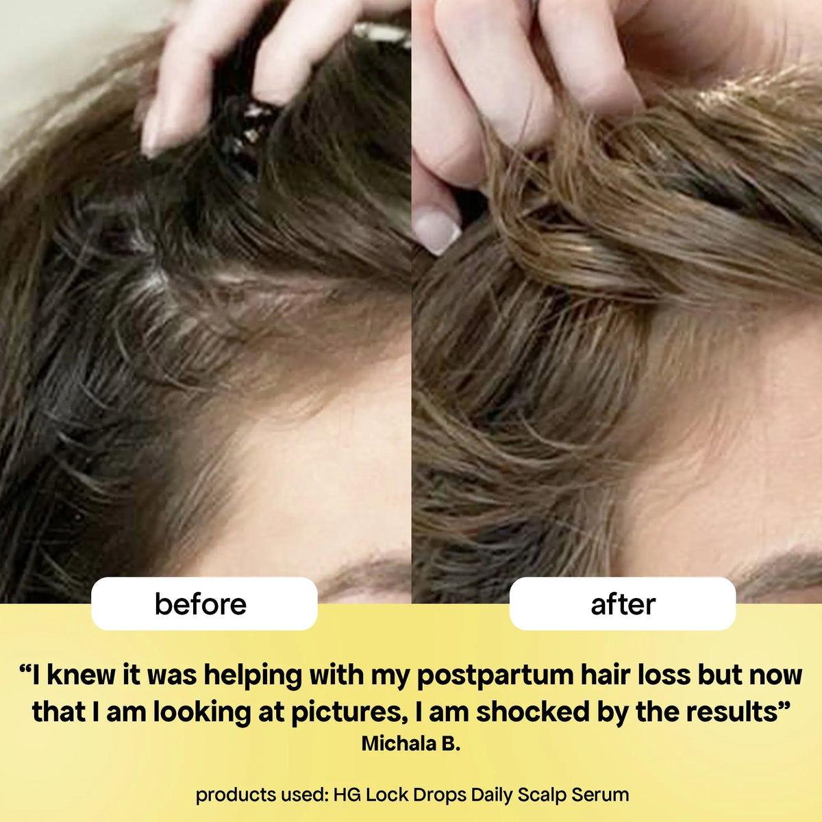 Lock Drops for Anti-Shedding – BondiBoost.com
