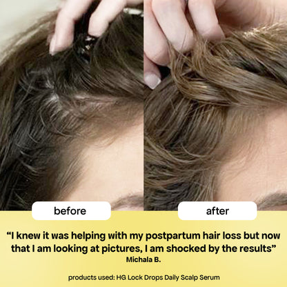 ANTI-THINNING SUPER SYSTEM