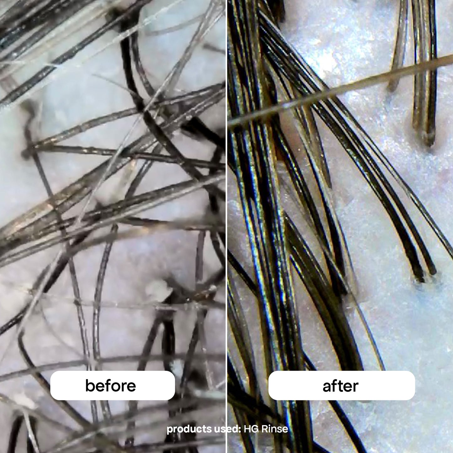 before and after using the hg rinse