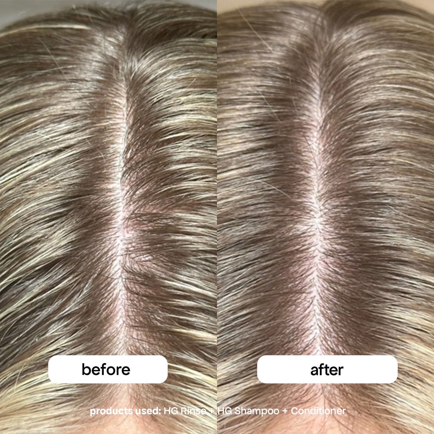 before and after scalp care using the rinse