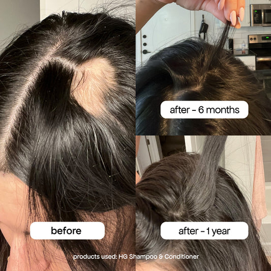 POSTPARTUM HAIR RECOVERY KIT